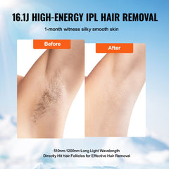 IPL Hair Removal, Permanent Hair Removal with Ice Cooling System for Women Men, Auto/Manual Modes & 5 Levels, Painless At-Home Hair Removal Device for Legs, Arms, Armpits, Bikini Line